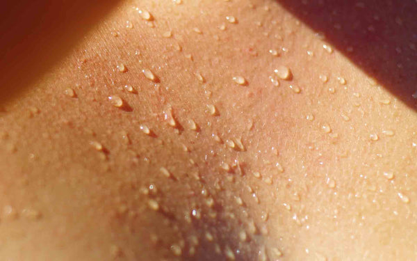 termorregulacion esclerosis múltiple dravet epilepsia